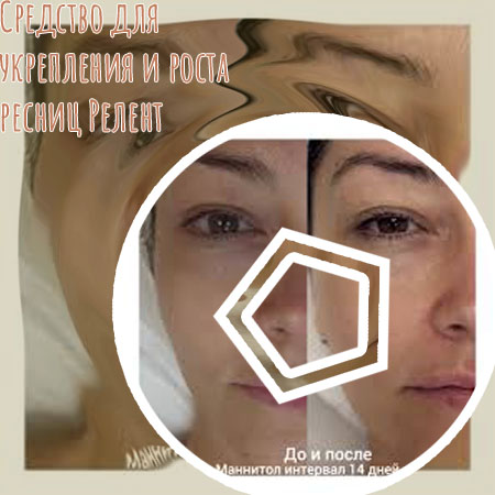 Где купить средство для лечения ресниц